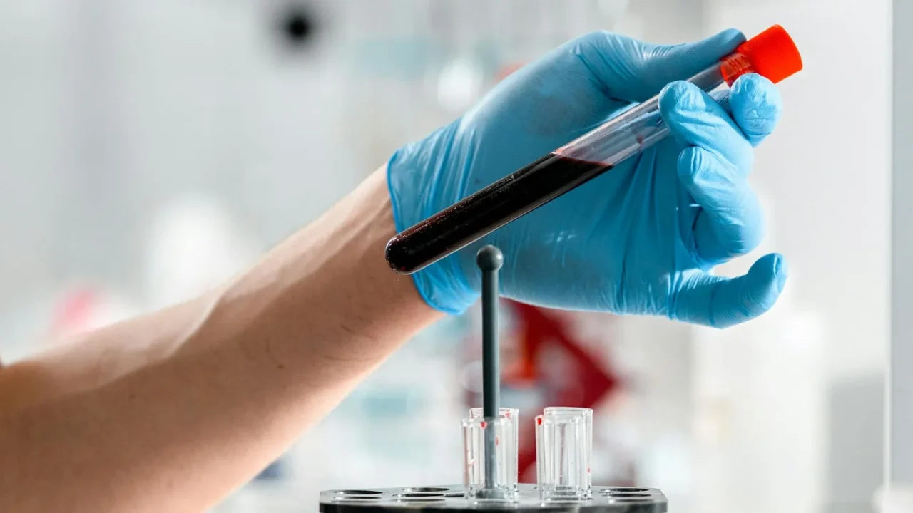BPOM Logo Laboratory Test