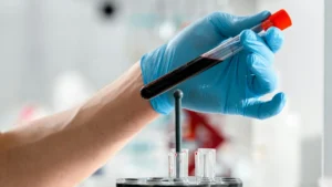 BPOM Logo Laboratory Test